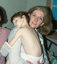Elizabeth Craze in 1984, one of the youngest transplant patients.