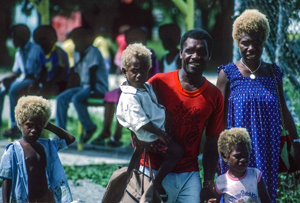 Naturally blond hair in Solomon Islanders rooted in native gene, study  finds | News Center | Stanford Medicine