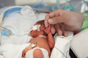 neonatal newborn at Lucile Packard Children's Hospital