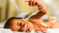 Infants’ race influences quality of hospital care in California