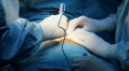 Surgical adhesions can be treated, prevented in mice