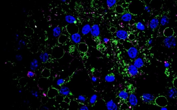 Resting neural stem cells (nuclei shown in blue) accumulate large protein aggregates (pink) in and around storage compartments called lysosomes (green). Xiaoai Zhao