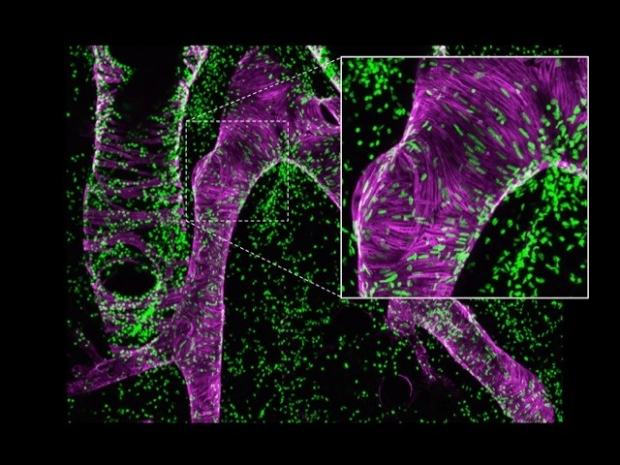 Airway and artery visualized using confocal microscope