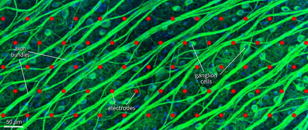 Ganglion cells and their axons are stained in green color. A high-resolution electrode array sits in close proximity to ganglion cell bodies but is also located next to axon bundles and can lead to unwanted axonal activation.