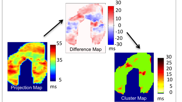 Cluster Analysis for Identifying Focal Cartilage Defects