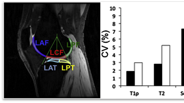 Knee Cartilage MRI T1rho (CubeQuant), T2 (qDESS) and Sodium (Cones) Variability