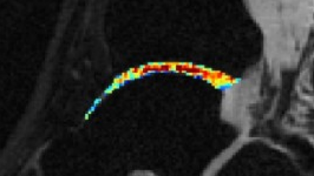 Rapid Volumetric Quantification of Cartilage Biochemistry with MRI