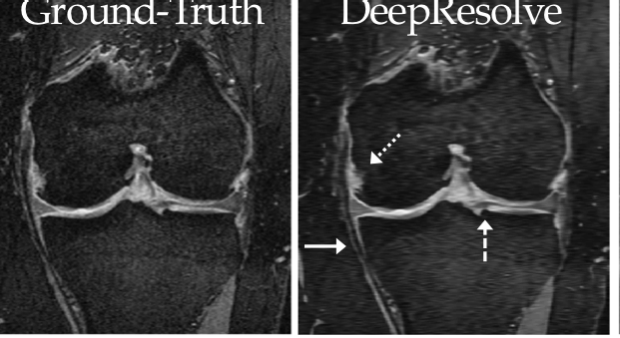 Super-Resolution Musculoskeletal MRI Using Deep Learning