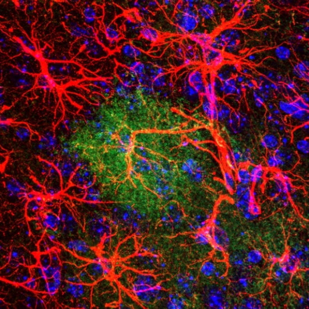 Astrocytes and Neuroinflammation