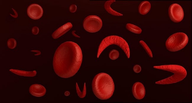 SickleCell