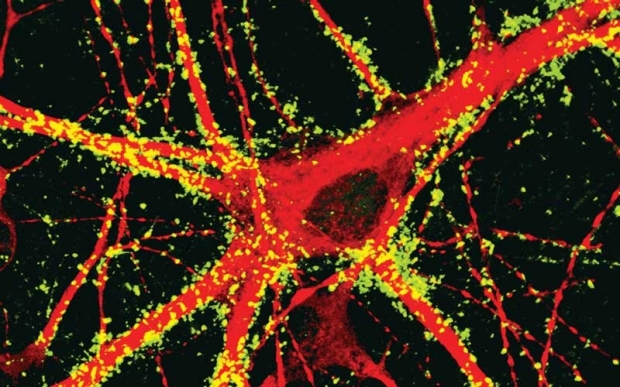 Human neurons stained for synapsins and MAP2