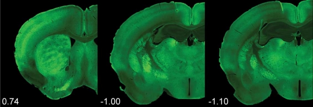 Coronal sections through a mouse brain illustrating the expression of Lphn2