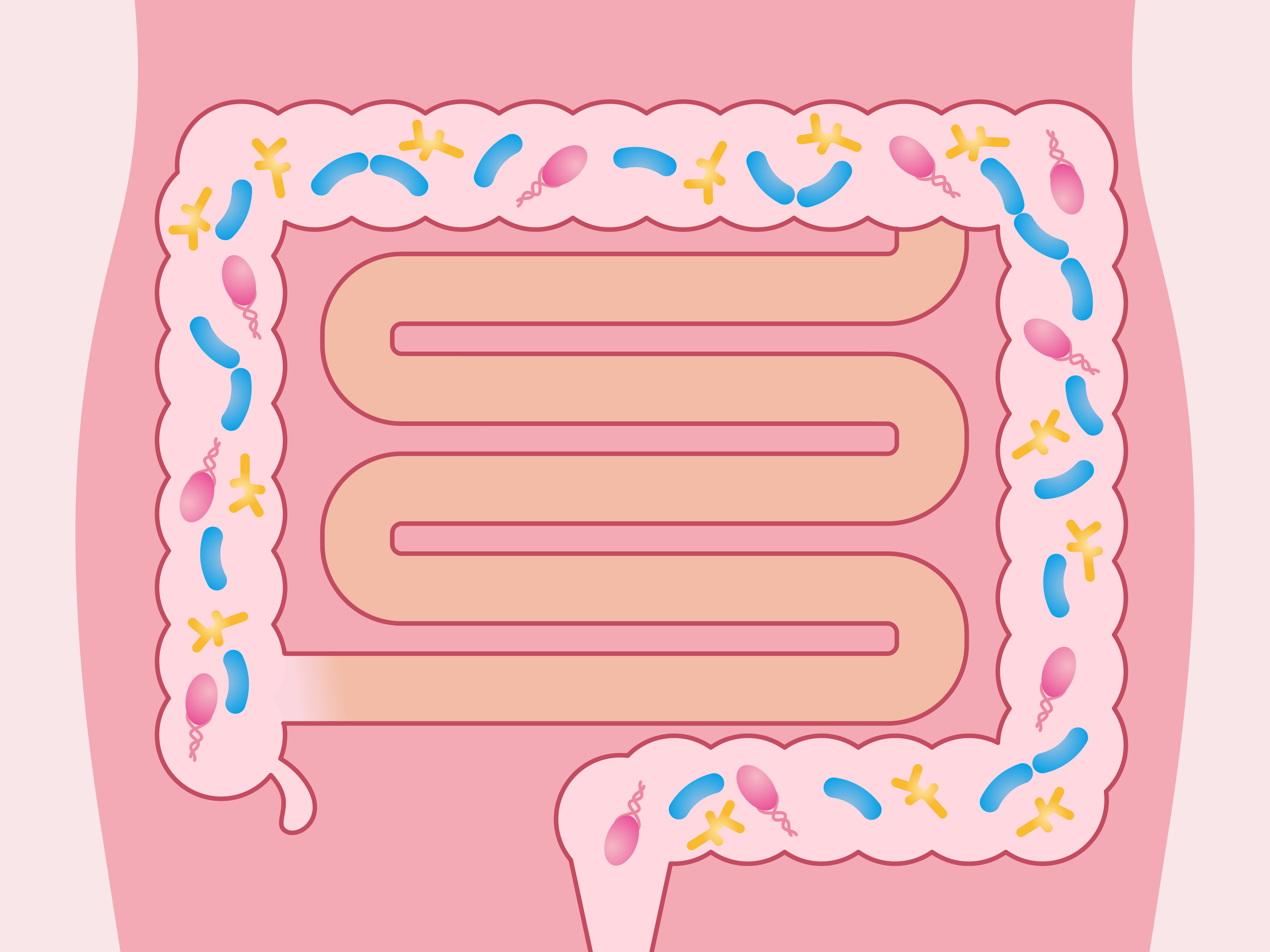 Stanford scientists link ulcerative colitis to missing gut microbes