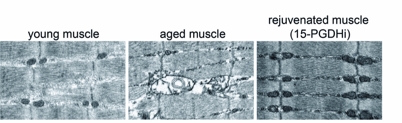 Small molecule restores muscle strength, boosts endurance in old mice, study finds