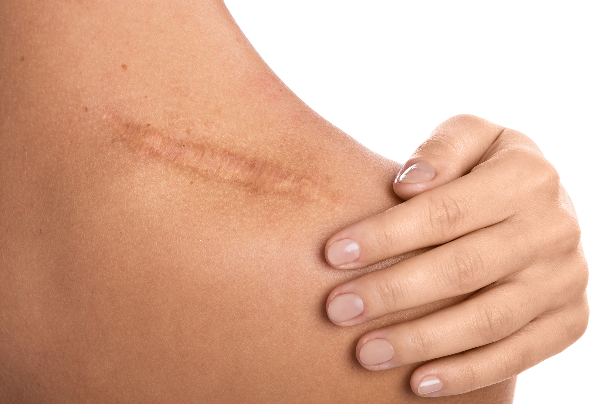 Healing from Within: Strategies to Eradicate Internal Scar Tissues