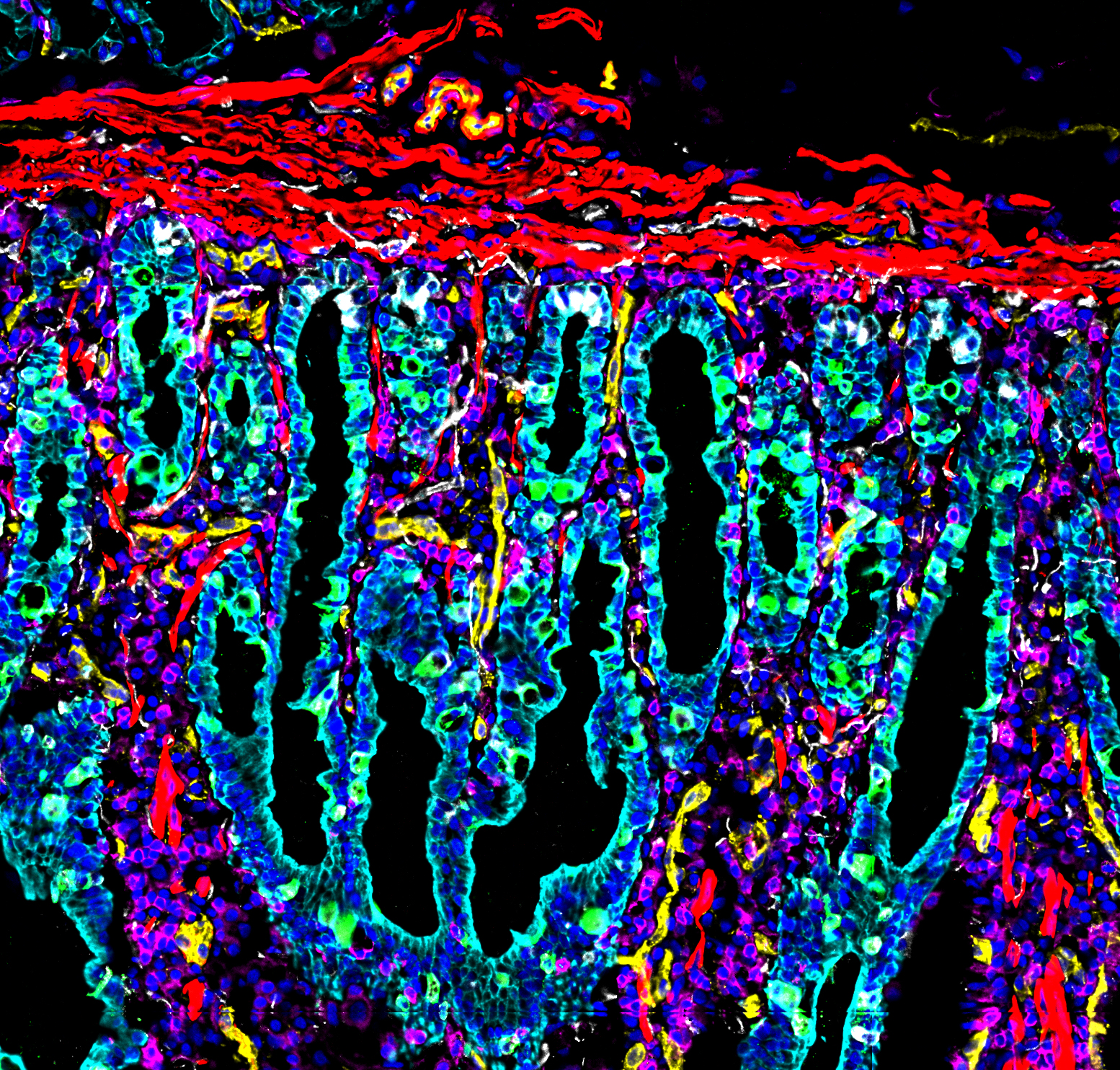 Stanford Medicine researchers take part in HuBMAP, showing what healthy human tissue looks like