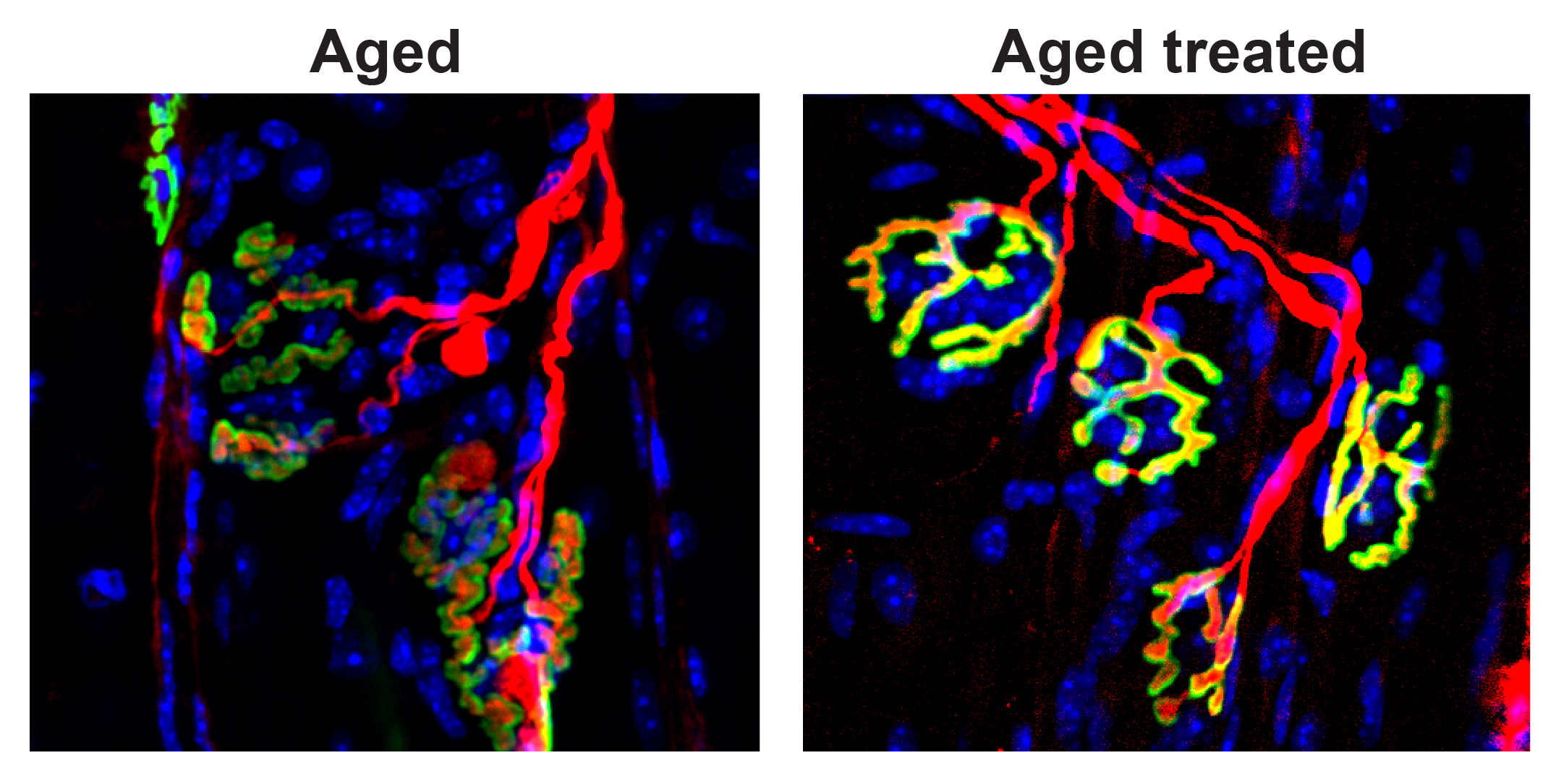 Restoring nerve-muscle connections boosts strength of aging mice, Stanford Medicine study finds