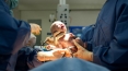 Optimal C-section rate may be as high as 19 percent to save lives of mothers and infants