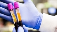 Cheap blood test can discriminate between bacterial, viral infections