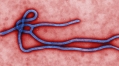 Study finds people with Ebola may not always show symptoms