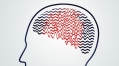 Study shows why even well-controlled epilepsy can disrupt thinking