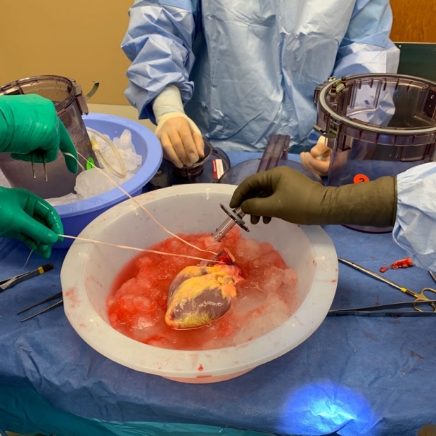 Donor heart ready for transplant at Stanford Health Care