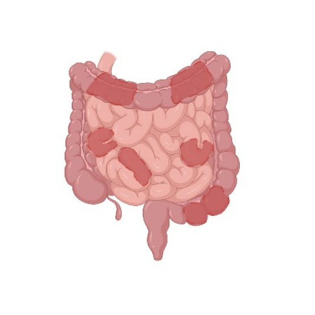 Image of a large and a small intestine