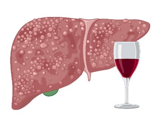 Drawing of a liver with alcohol disease and a glass of red wine