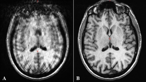 good and bad brain scans