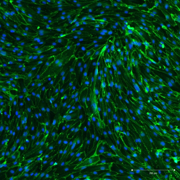 Endothelial cells derived from human induced pluripotent stem cells