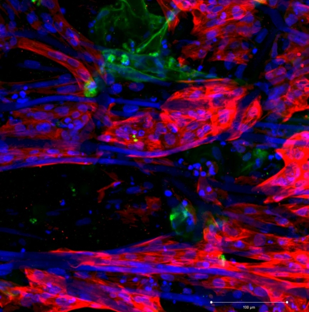 Co-culture of human induced pluripotent stem cell-derived endothelial cells (green) and cardiomyocytes (red)