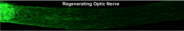 Regenerating Optic Nerve
