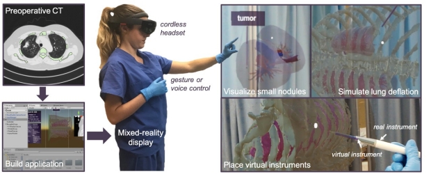 Mixed-reality visualization tool for thoracic surgical planning
