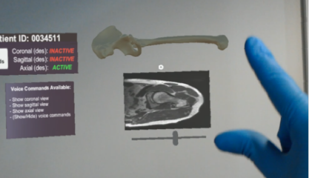 Mixed reality for orthopedic surgery