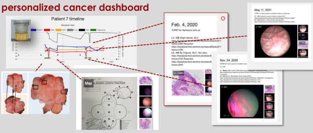 bladder cancer management dashboard