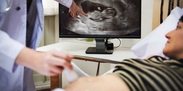 woman and ultrasound