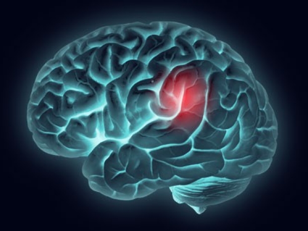 illustration of brain with hot zone