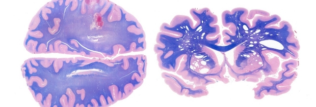histology image of brain tissue