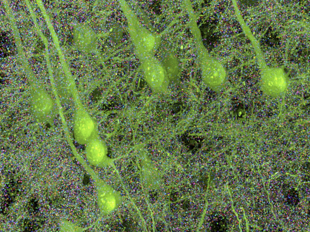 Image of synaptic phenotypes