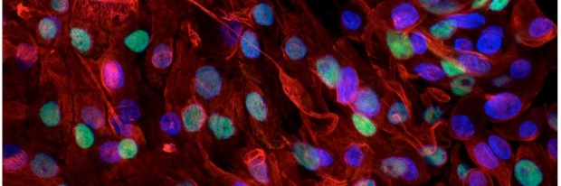 Human-upper-airway-basal-stem-cells-UABCs
