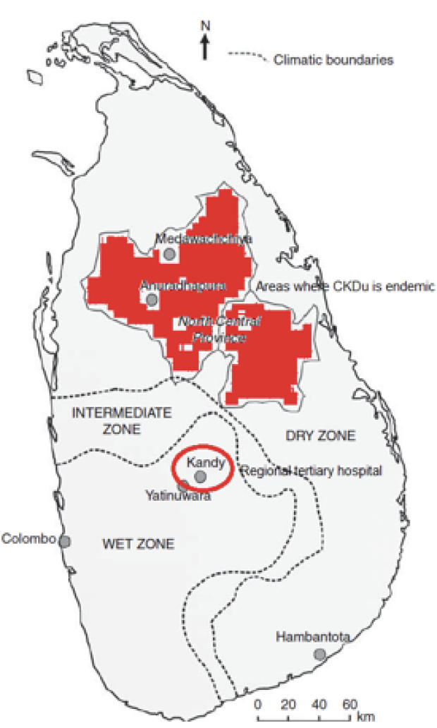 Areas where CKDu is endemic