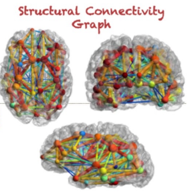 Brain Connectivity Mapping