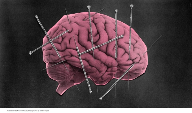 GQ accupuncture brain illustration by Michael Houtz