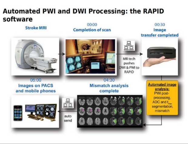 Image showing the PWI process from scan to analysis to Doctor's devices