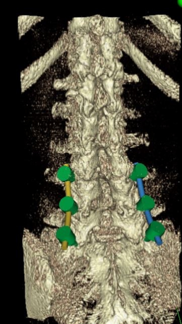 spine 3D image