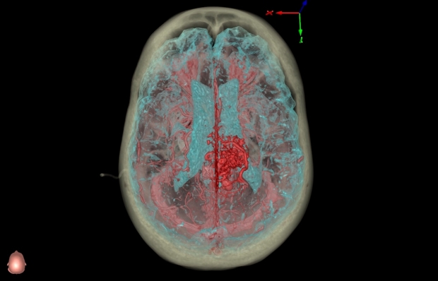Image of brain scan using 3D virtual reality technology