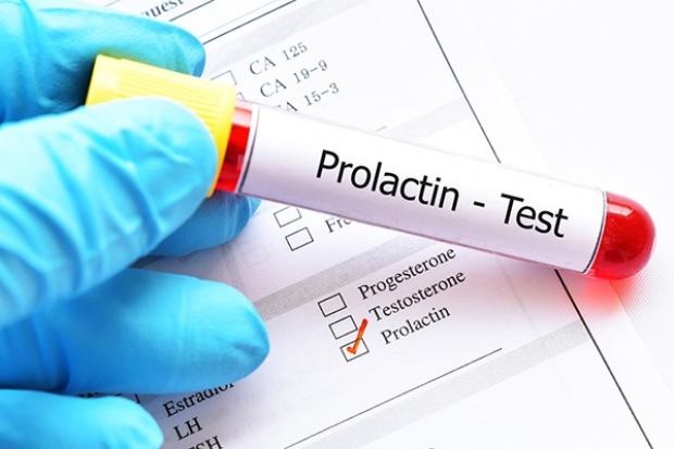 prolactin test image