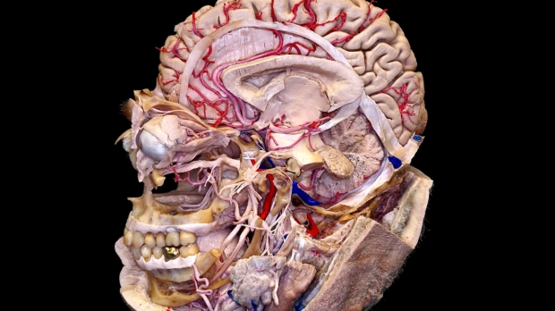 microsurgical neuroanatomy image