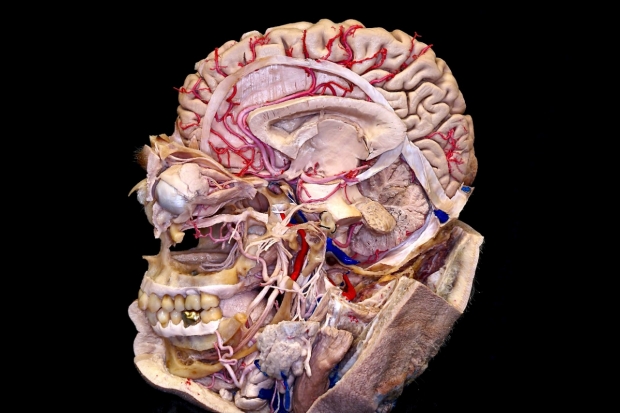 microsurgical_neuroanatomy