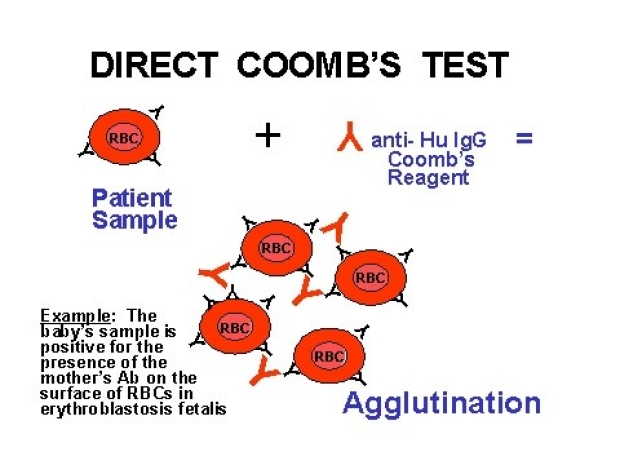 direct Coomb's Test diagram
